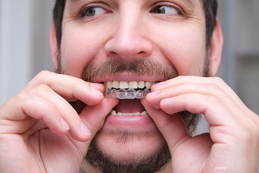 Master Your Invisalign with 12 Vital Hacks