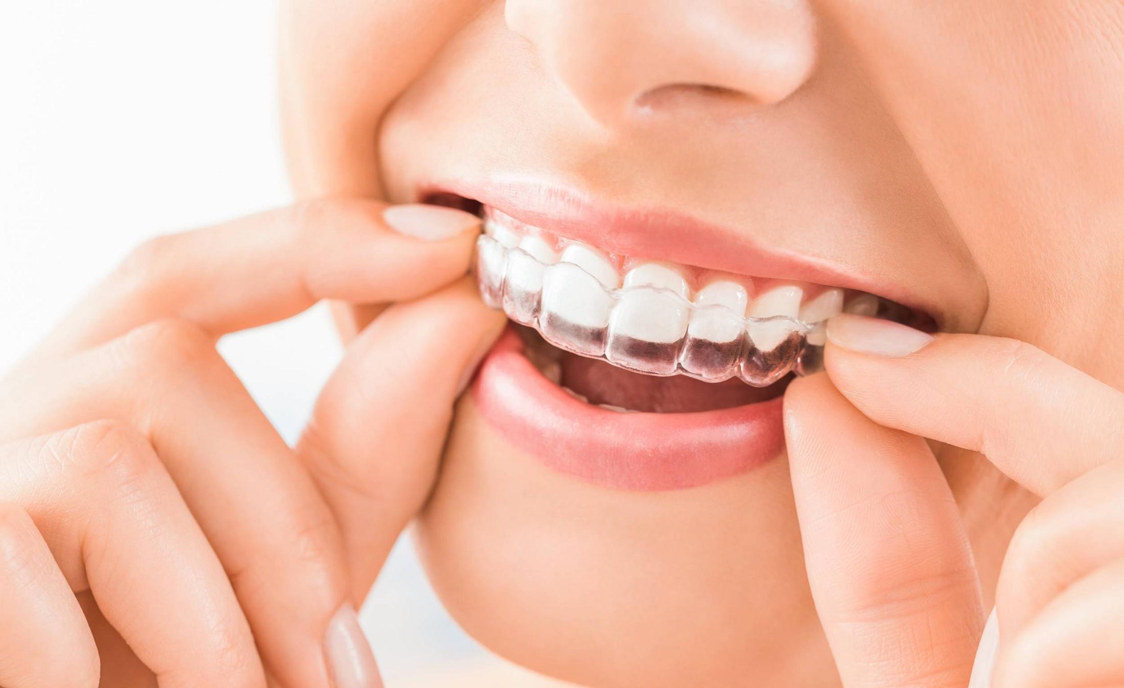 Explore Oral Health with Our Strobel Dentistry Blog