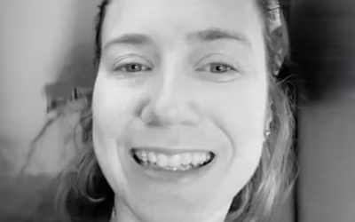 Exactly How Are Teeth Supposed to Line Up?